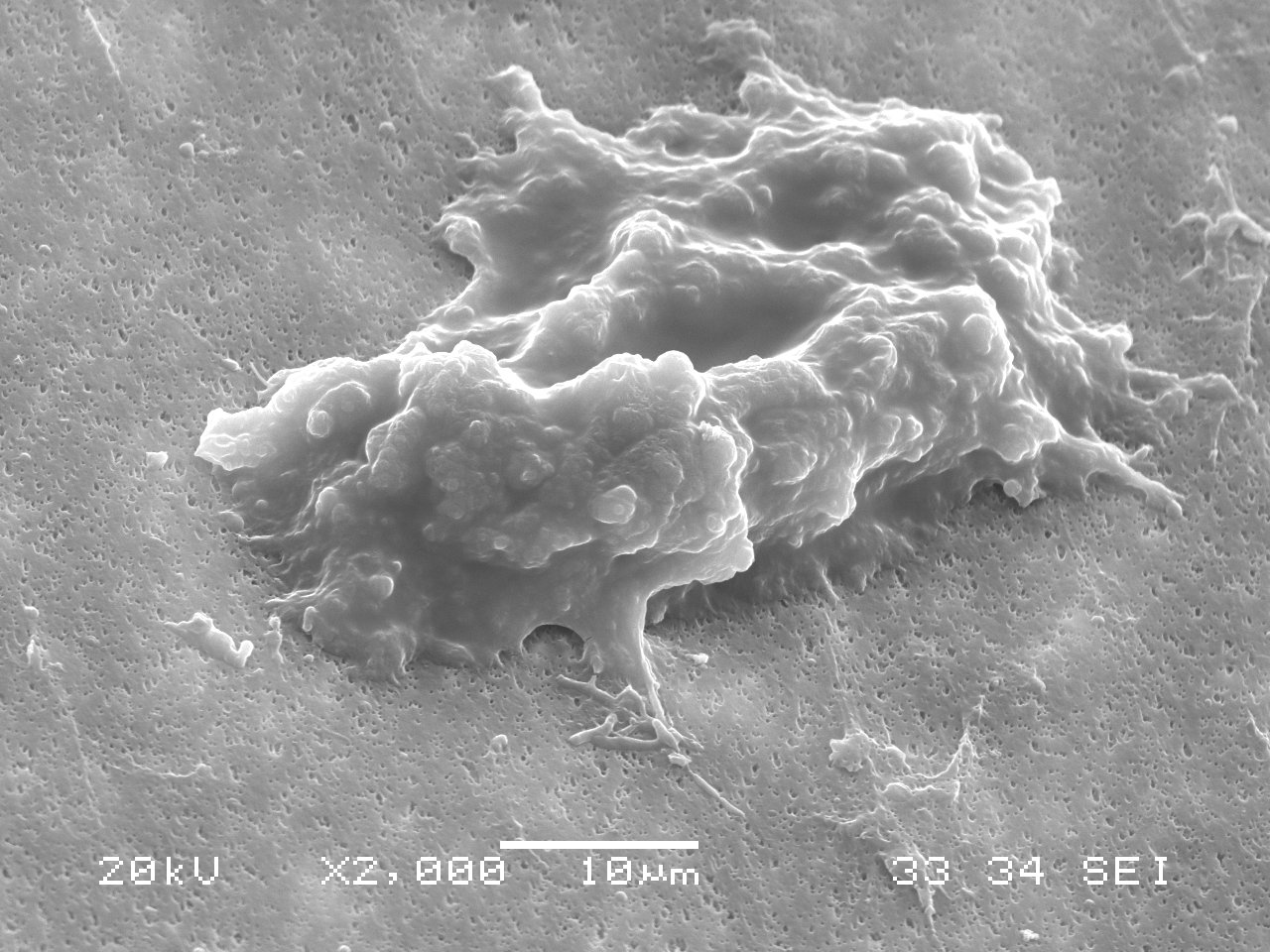 4-aPL human plasma, 45 degree tilt