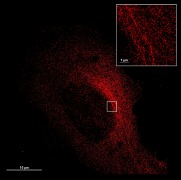 Annexin 5 staining on trophoblasts Annexin 5 staining on trophoblasts