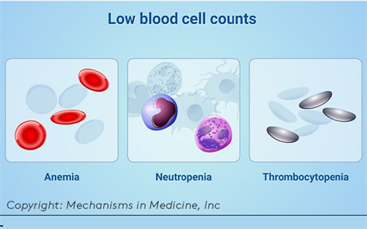 graphic of low blood cell count types