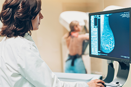 Provider looking at an X-ray image of a breast on a computer screen.